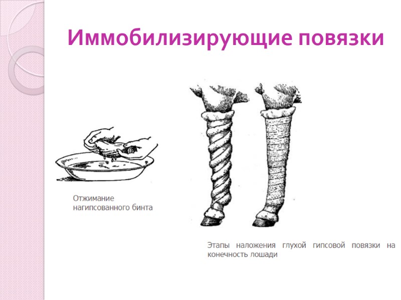Иммобилизирующие повязки
